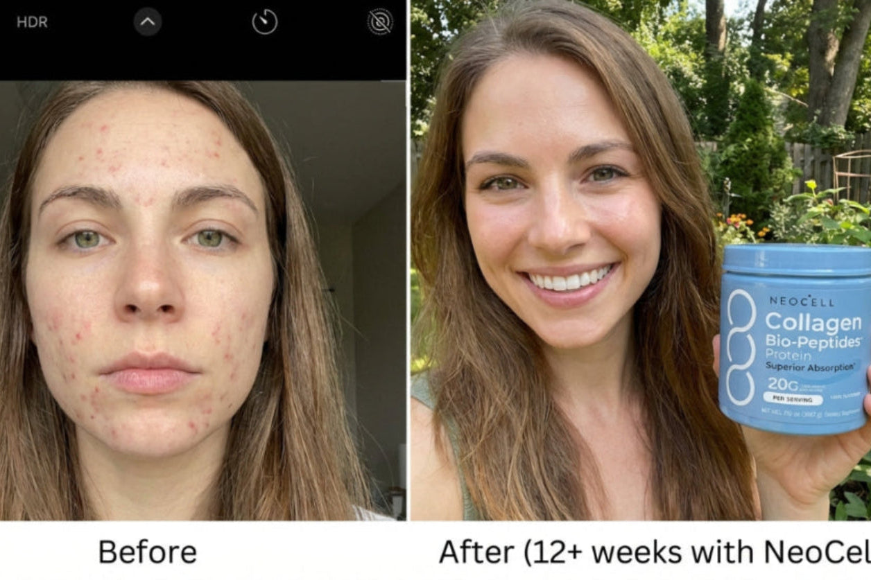 Before and after comparison of a woman's face with NeoCell Collagen product.
